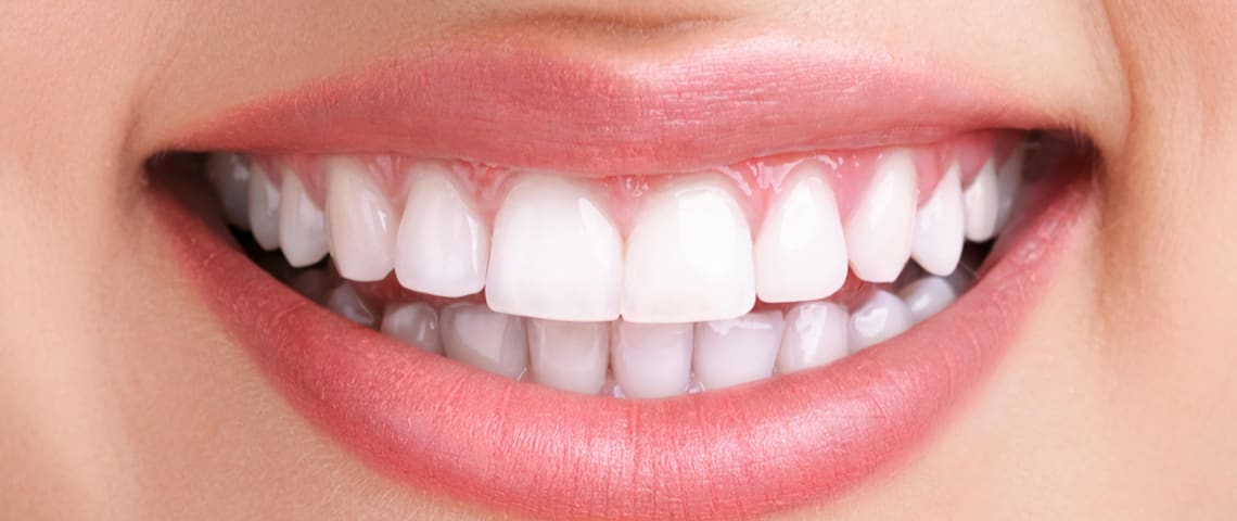 teeth whitening jhelum